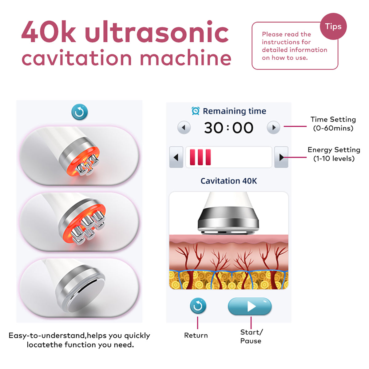 SQ169 Basic – Συσκευή σπηλαίωσης 40K 3 σε 1 με τριπολικές και εξαπολικές RF
