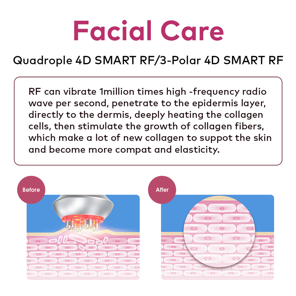 SQ90E Plus – Συσκευή σπηλαίωσης 80K 9 σε 1 με RF, EMS, λέιζερ και μικρορεύμα