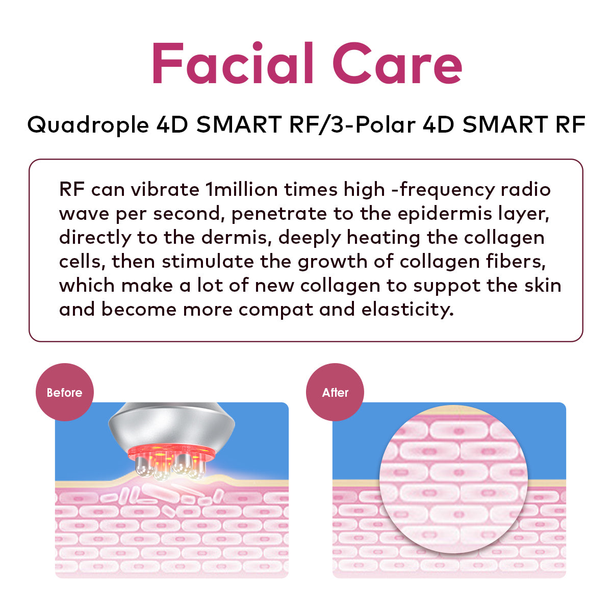 SQ121C Plus – Συσκευή σπηλαίωσης 80K 9 σε 1 με επιθέματα λέιζερ, EMS και BIO LED